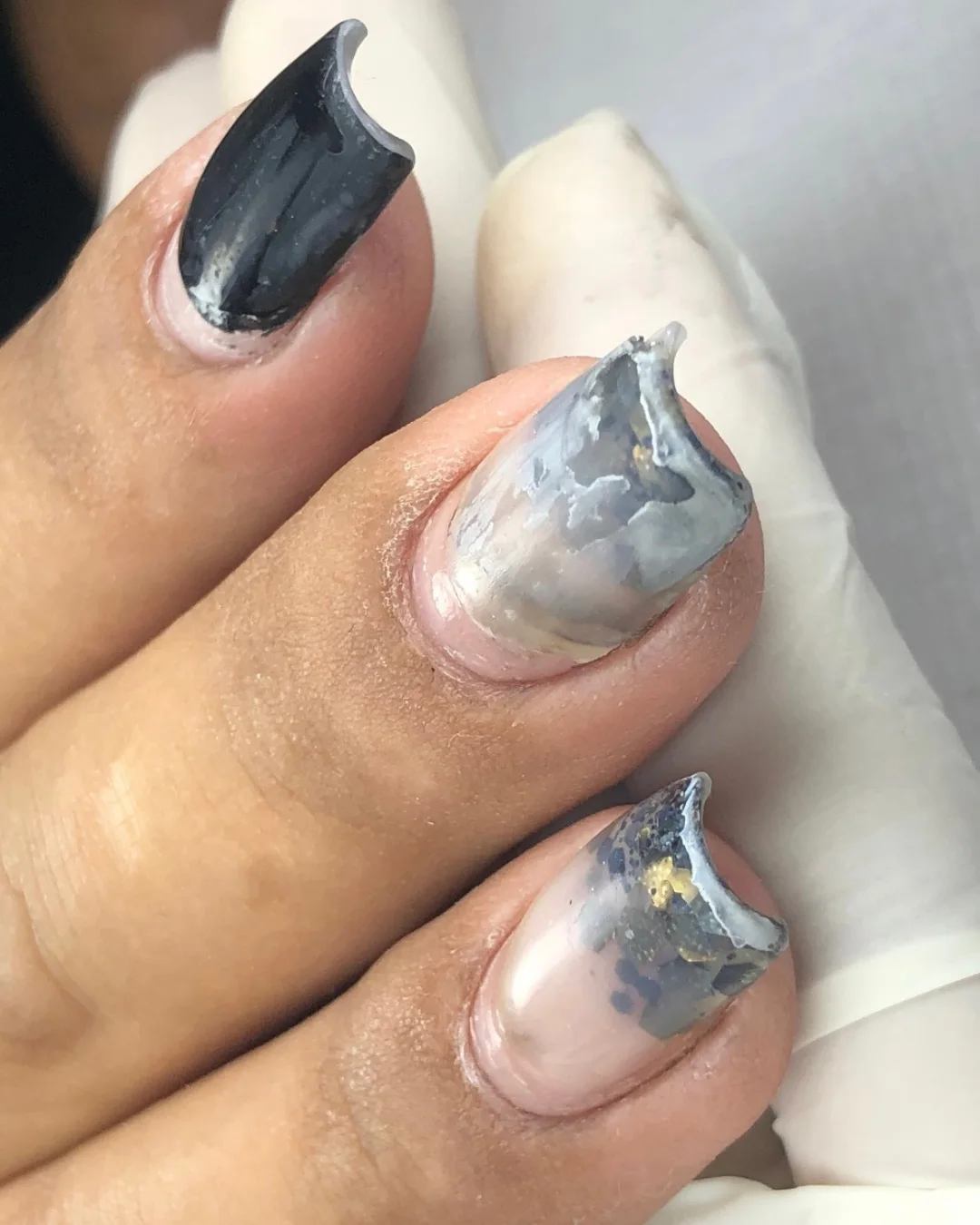 Veio de outra profissional: erro de estrutura, degrau alto por excesso de gel e infiltração.